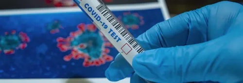 Des arnaqueurs proposent des faux kits de tests dans la région