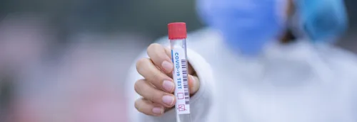 Un drive de dépistage installé à Lille pour des tests antigéniques