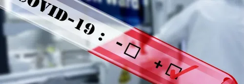 Une campagne de dépistage massif se précise à Lille