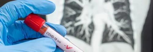 Dépistage massif à Roubaix : les modalités se précisent