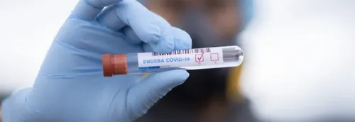 Les autotests disponibles en pharmacie dès cette semaine