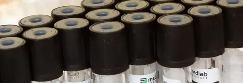 Un dépistage mené chez les mineurs dans le Pas-de-Calais