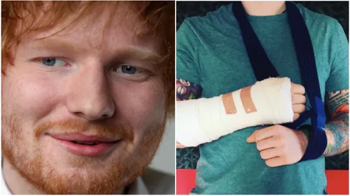 Ed Sheeran s'est fait renverser par une voiture à Londres
