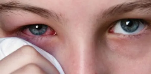 Le "jeu du piment", nouveau défi dangereux des cours de récré