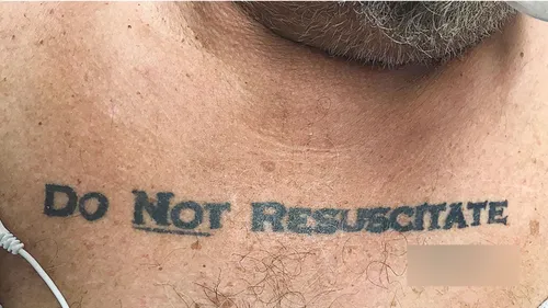 Il avait un tatouage "ne pas réanimer", les médecins le laissent...