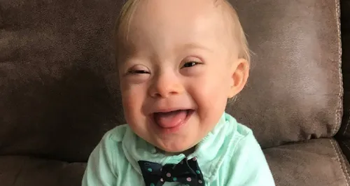 Un bébé trisomique remporte le prix du plus beau bébé d'Amérique
