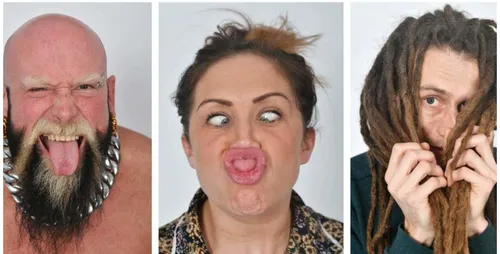 Ugly Models, une agence pour mannequins imparfaits !