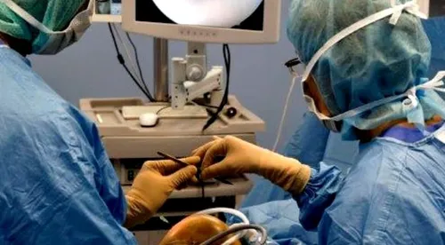 Le chirurgien l'opère de la carotide alors que l'anesthésie n'a pas...