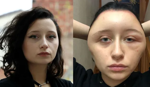 Gravement défigurée, elle frôle la mort à cause… d’une coloration...