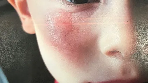 Roquevaire : un instituteur frotte la joue d’un enfant avec une...