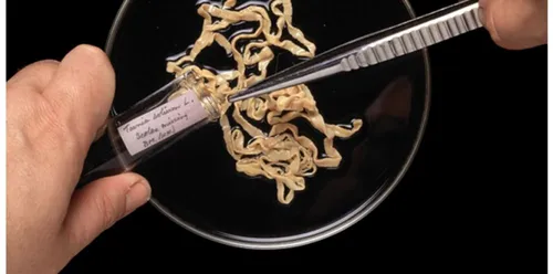 Un tas de larves de ver solitaire découvert dans le cerveau d'une...