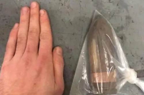 Un patient débarque avec un obus dans le rectum : branle-bas de...