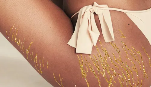 Cette artiste espagnole transforme les vergetures des femmes en...