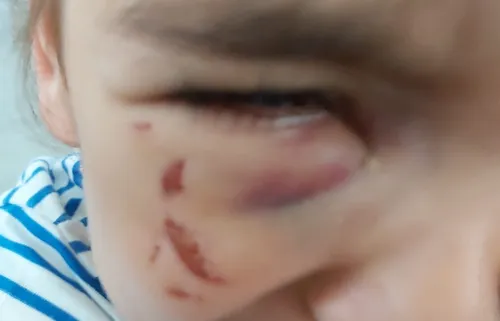 Une fillette de 2 ans blessée par une toxicomane près du jardin...