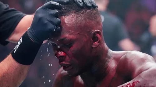 Israel Adesanya réagit après sa défaite au TKO face à Joe Pyfer