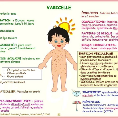 [ SANTE ] Attention au retour de la varicelle