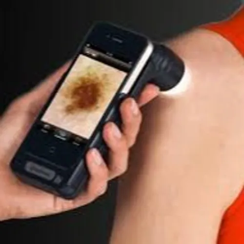 [ SANTE ] Les cancers de la peau sous surveillance dans le pays...