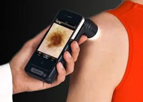 [ SANTE ] Les cancers de la peau sous surveillance dans le pays...