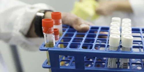 [ SOCIETE ] Grève des Laboratoires d’Analyses Médicales : Les...