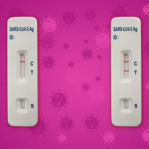 Hausse de l'épidémie de Covid-19 en France