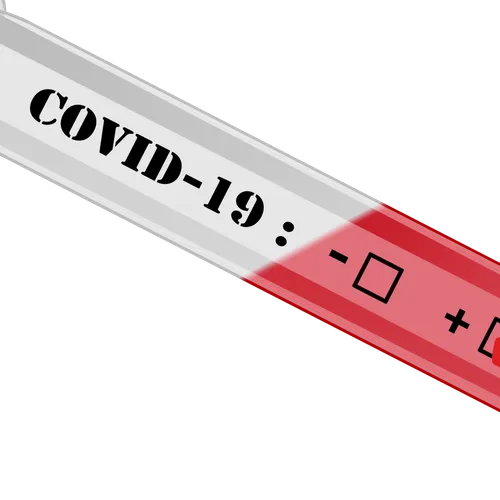 9/03/22 : Légère hausse des contaminations au Covid-19 dans les...