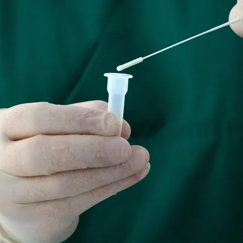 Hantavirus : la France active un dispositif sanitaire d’urgence