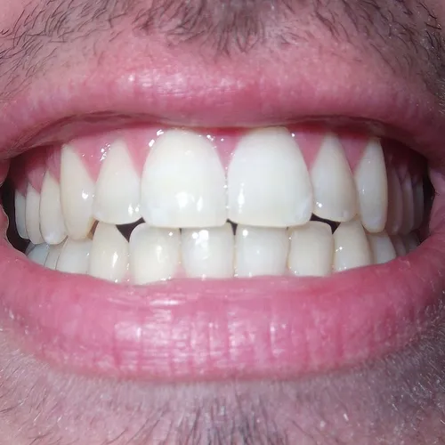 L'attente pour prendre soin de ses dents a peu varié dans l'Oise
