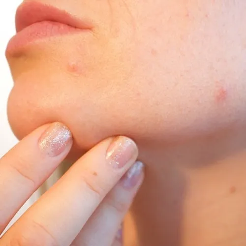 Hauts-de-France : l'IA s'invite dans le dépistage du cancer de la peau