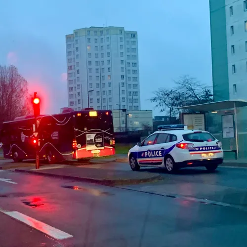 Calais : un homme brûlé au visage après une agression