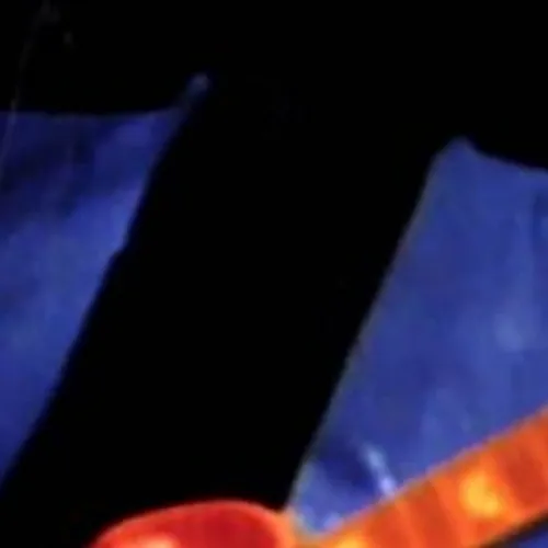 Dire Straits à la foire de Châlons