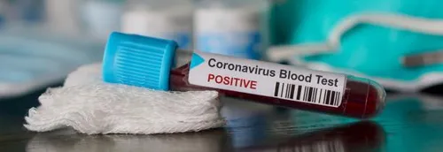 Journal 12h - Une femme porteuse du coronavirus dans le Nord