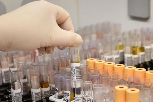 Journal 7h - Beaucoup de laboratoires d'analyses médicales fermés...