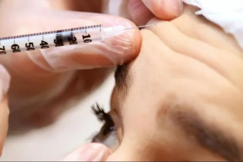 Journal 12h - Injections illégales de botox : La Cour d'appel de...