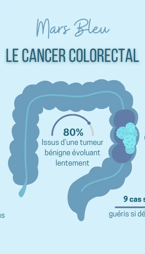Le taux de dépistage du cancer colorectal toujours "dérisoire",...