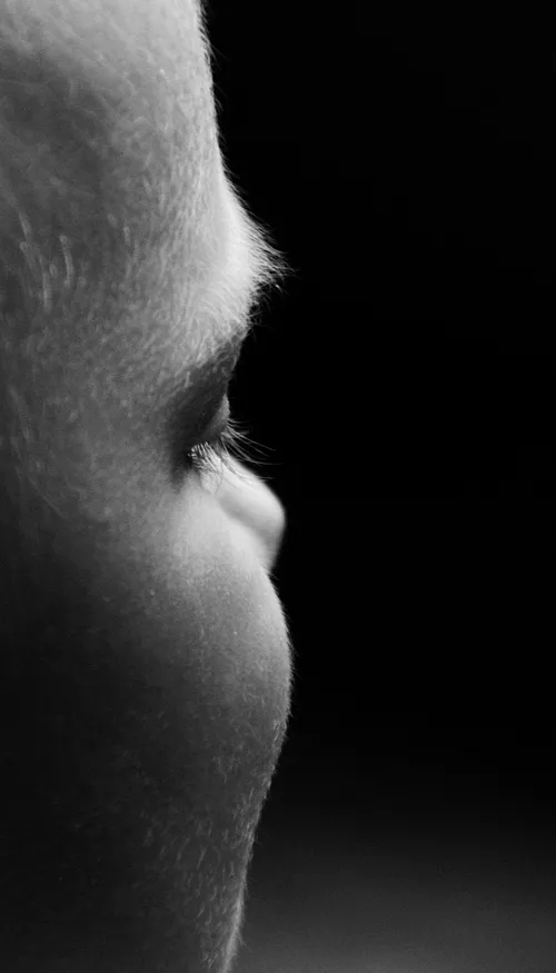 Sans oreille depuis sa naissance, Ava s’envole aux États-Unis pour...
