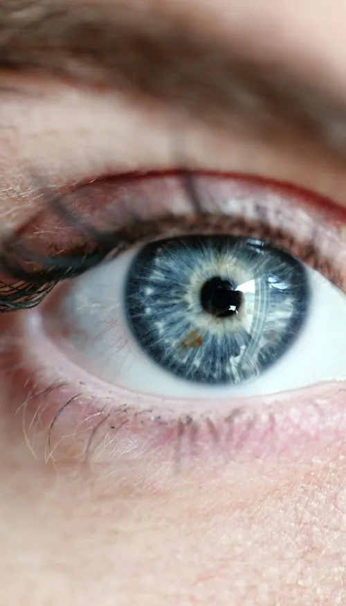 Des implants cornéens à partir... d’écailles de poisson