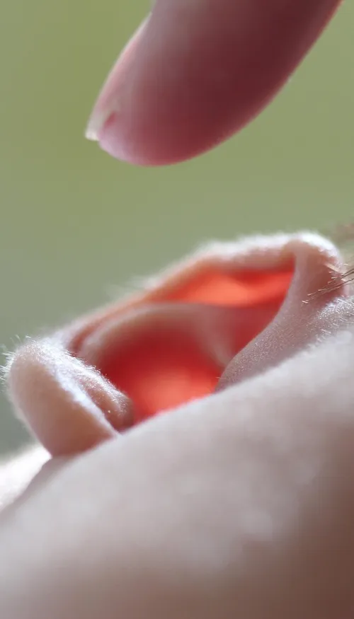 Ava, née sans oreilles, commence à entendre après une première...